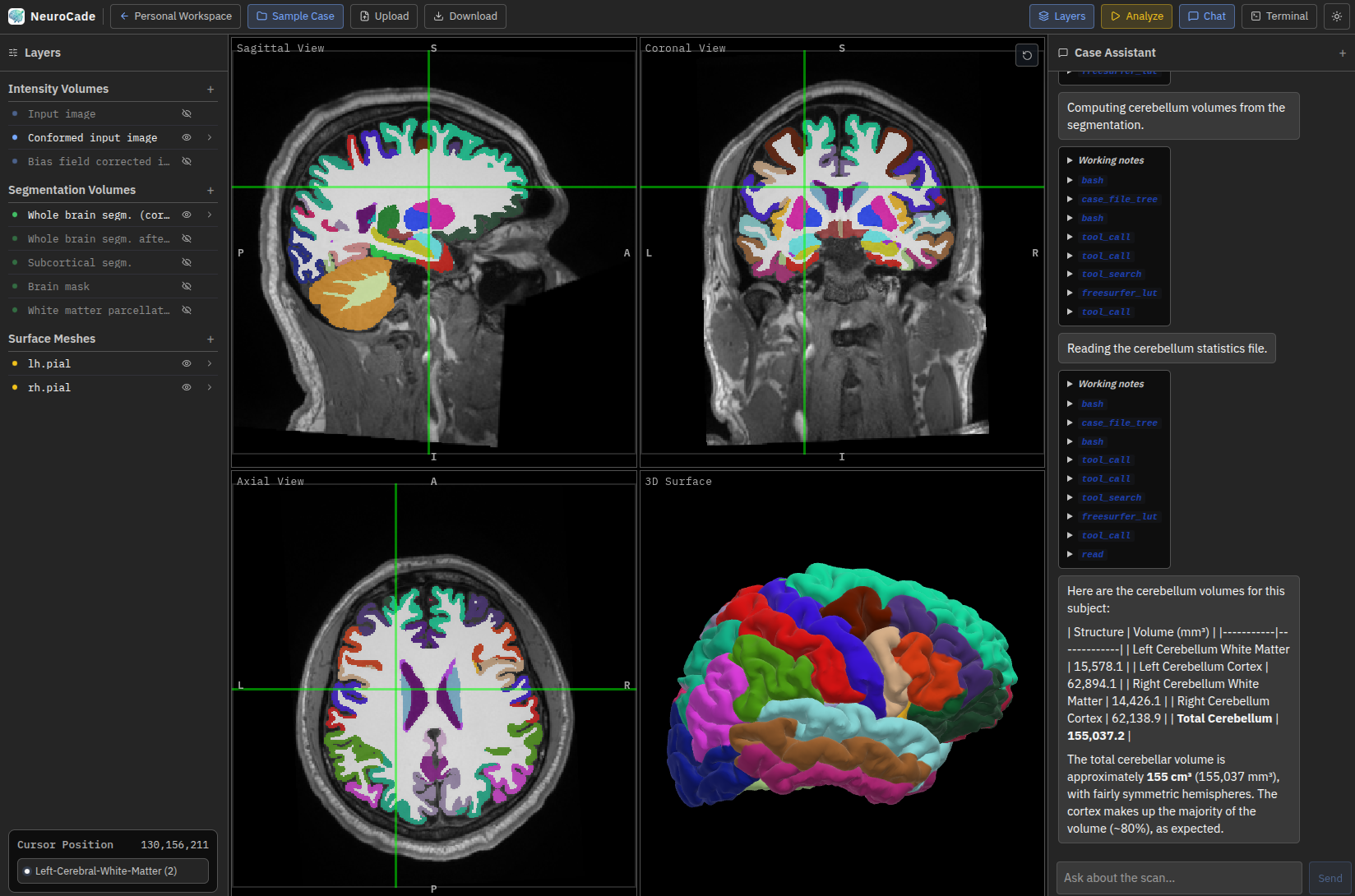 NeuroCade sample case workspace showing MRI views, layers, and assistant panel